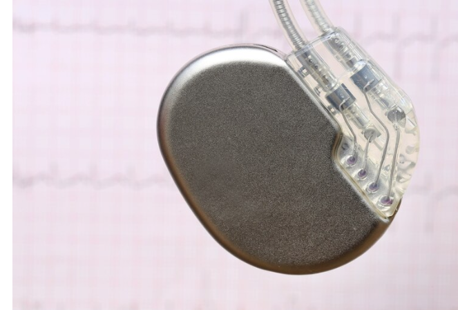 Living with a Pacemaker: What You Need to Know